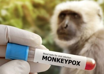 8 Fakta Wabah Cacar Monyet